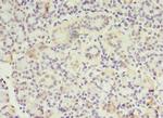 MTRR Antibody in Immunohistochemistry (Paraffin) (IHC (P))