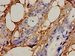 ICK Antibody in Immunohistochemistry (Paraffin) (IHC (P))