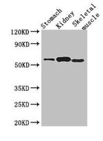 PPM1H Antibody in Western Blot (WB)