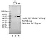 ZIC2 Antibody in Immunoprecipitation (IP)