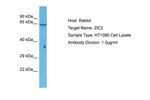 ZIC2 Antibody in Western Blot (WB)