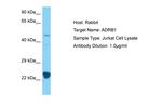 beta-1 Adrenergic Receptor Antibody in Western Blot (WB)