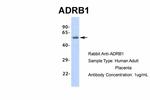 beta-1 Adrenergic Receptor Antibody in Western Blot (WB)