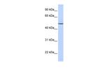 beta-1 Adrenergic Receptor Antibody in Western Blot (WB)