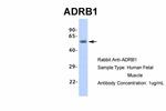 beta-1 Adrenergic Receptor Antibody in Western Blot (WB)