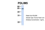 PDLIM5 Antibody in Western Blot (WB)