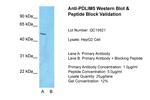 PDLIM5 Antibody in Western Blot (WB)