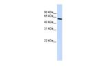 PDLIM5 Antibody in Western Blot (WB)