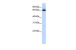 KBTBD5 Antibody in Western Blot (WB)