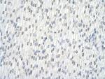 hnRNP L Antibody in Immunohistochemistry (Paraffin) (IHC (P))