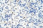 hnRNP L Antibody in Immunohistochemistry (Paraffin) (IHC (P))