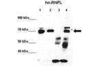 hnRNP L Antibody in Immunoprecipitation (IP)