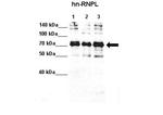 hnRNP L Antibody in Western Blot (WB)