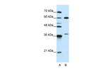 hnRNP L Antibody in Western Blot (WB)