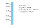 Alcohol Dehydrogenase 1A Antibody in Western Blot (WB)