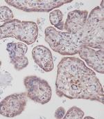 Bcl-2 Antibody in Immunohistochemistry (Paraffin) (IHC (P))