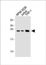 Bcl-2 Antibody in Western Blot (WB)