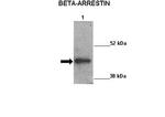 beta-Arrestin 2 Antibody in Western Blot (WB)