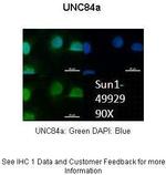 UNC84A Antibody in Immunocytochemistry (ICC/IF)