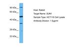 UNC84A Antibody in Western Blot (WB)