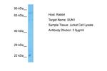 UNC84A Antibody in Western Blot (WB)