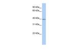 TXNIP Antibody in Western Blot (WB)