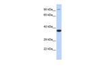 BBS5 Antibody in Western Blot (WB)