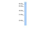 AGBL5 Antibody in Western Blot (WB)