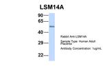 LSM14A Antibody in Western Blot (WB)