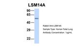 LSM14A Antibody in Western Blot (WB)