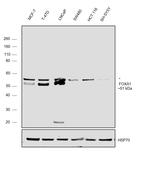 FOXA1 Antibody in Western Blot (WB)