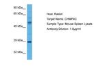 CHMP4C Antibody in Western Blot (WB)