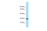 CLEC2A Antibody in Western Blot (WB)