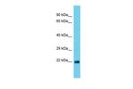 ATG101 Antibody in Western Blot (WB)