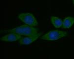 Syntrophin alpha-1 Antibody in Immunocytochemistry (ICC/IF)