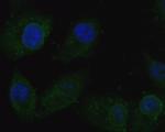CACNG2 Antibody in Immunocytochemistry (ICC/IF)