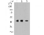 CACNG2 Antibody in Western Blot (WB)