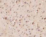 KCNK2 Antibody in Immunohistochemistry (Paraffin) (IHC (P))