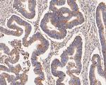 KCNK9 Antibody in Immunohistochemistry (Paraffin) (IHC (P))