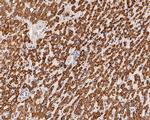 KCNK9 Antibody in Immunohistochemistry (Paraffin) (IHC (P))