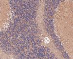 KCNK9 Antibody in Immunohistochemistry (Paraffin) (IHC (P))