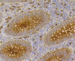 CEACAM6 Antibody in Immunohistochemistry (Paraffin) (IHC (P))