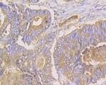 CEACAM6 Antibody in Immunohistochemistry (Paraffin) (IHC (P))