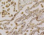 CEACAM6 Antibody in Immunohistochemistry (Paraffin) (IHC (P))