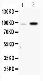 Fibrinogen alpha chain Antibody in Western Blot (WB)