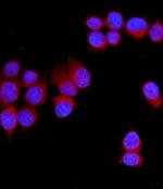 SLC11A1 Antibody in Immunocytochemistry (ICC/IF)