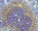 SLC11A1 Antibody in Immunohistochemistry (Paraffin) (IHC (P))