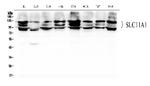 SLC11A1 Antibody in Western Blot (WB)