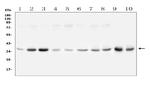 GPD1L Antibody in Western Blot (WB)