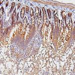 TDRD3 Antibody in Immunohistochemistry (Paraffin) (IHC (P))